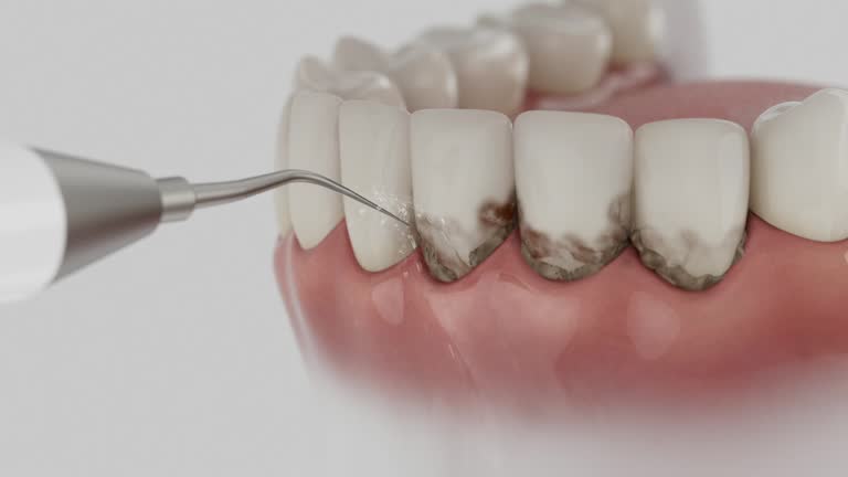 Reliable Tooth Extraction contractor in Vilonia, AR by Smile Center Dentistry